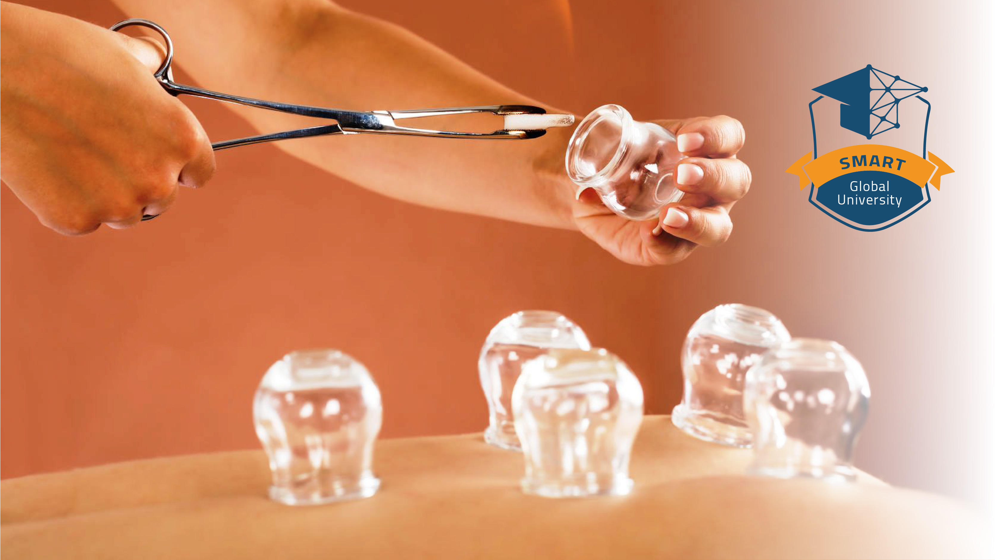 Department of Medical Sciences - Cupping Science